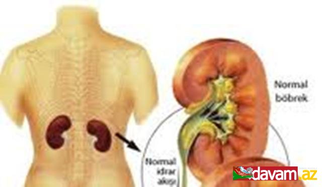 Böyrək xəstəliyinin fəsadları - Ehtiyatlı olun